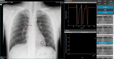 <p>　研究グループが公開した研究機での解析の様子（コニカミノルタ提供）</p>