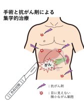 化学療法、再発少なく　微小細胞への効果期待　胆道・膵臓がん治療の進歩　千葉県がんセンター肝胆膵外科部長　賀川真吾　【９月はがん征圧月間　ちば　がんにうち克つ】（６）
