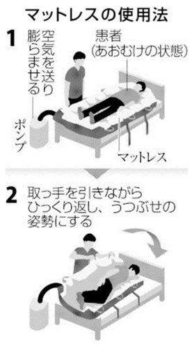 看護師を“空気”で支援　力業の体位変換「気軽に」　導入増、人手不足解消も期待　八千代の「名優」輸入販売のマットレス
